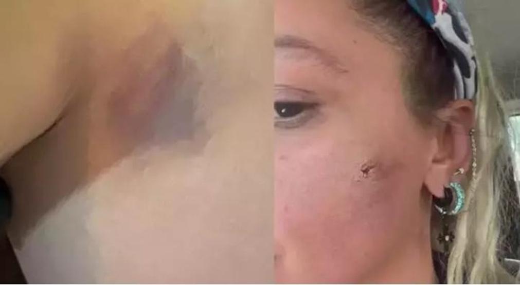 Şiddet İddiası Gündemden Düşmüyor Yıldız Asyalı’dan Yeni Paylaşım: “Ben Canımdan Korkuyorum”