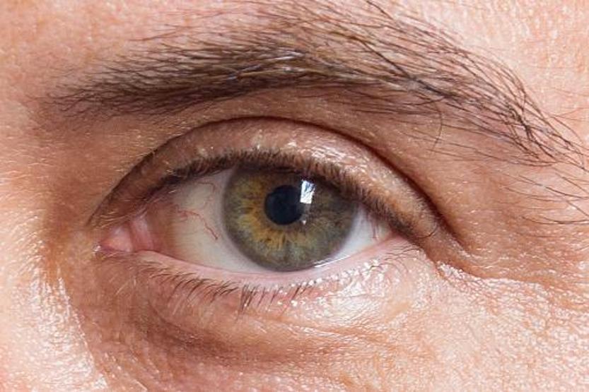 Göz Sağlığını Korumak İçin Sigara ve Diğer Zararlı Alışkanlıklardan Kaçınmanın Önemi