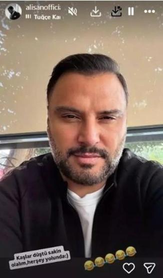 Alişan’dan “botoks” söylentilerine net yanıt Kaş detayı gündem oldu