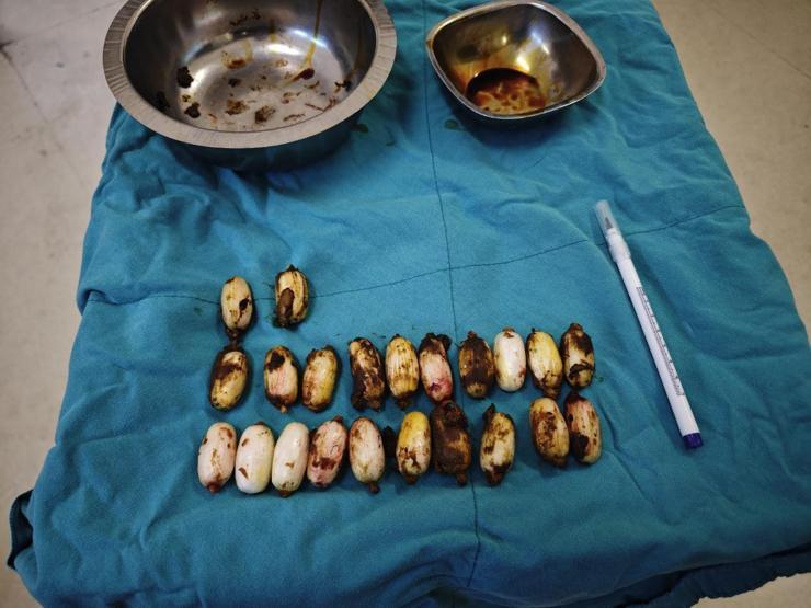 Polisin şüphesi üzerine durduruldu Midesinden çıkanlar şoke etti