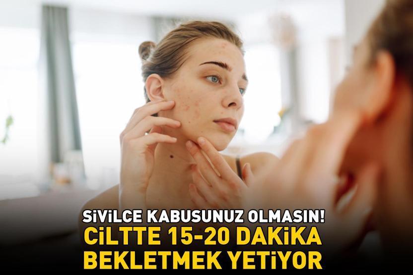 SİVİLCELERİN KÖKÜNÜ KURUTAN YÖNTEM Doğal antiseptik ve nemlendirici Ciltte 15–20 dakika bekletmek yetiyor