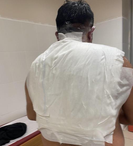 Sivas’ta gündem olan olay: ‘Buz tutar’ dedi, kendini yaktı