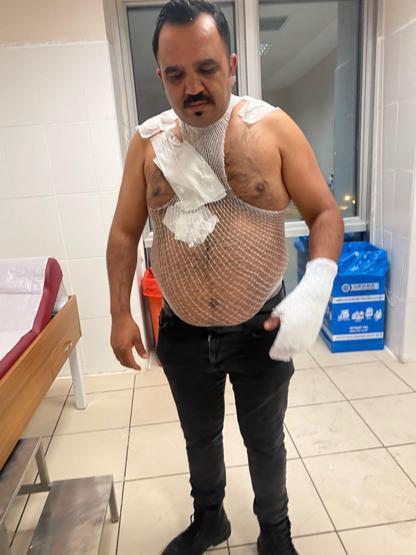 Sivas’ta gündem olan olay: ‘Buz tutar’ dedi, kendini yaktı