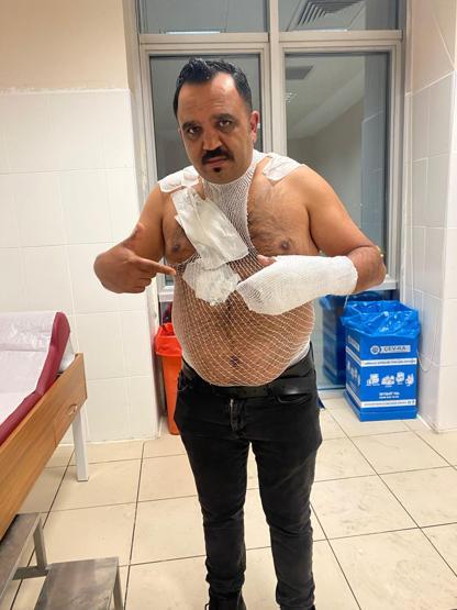 Sivas’ta gündem olan olay: ‘Buz tutar’ dedi, kendini yaktı