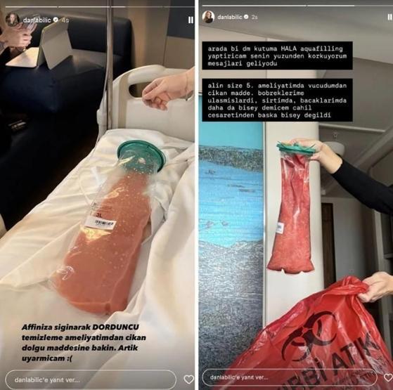 Kalça estetiği kabusu bitmiyor Danla Bilic 6. kez ameliyat masasına yatıyor