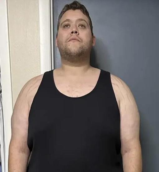 4 ADIMDA 68 KİLO VERDİ Tip 2 diyabet ve tansiyon ilaçlarını bile bıraktı 32 yaşındaki adam zayıflama sırrını açıkladı