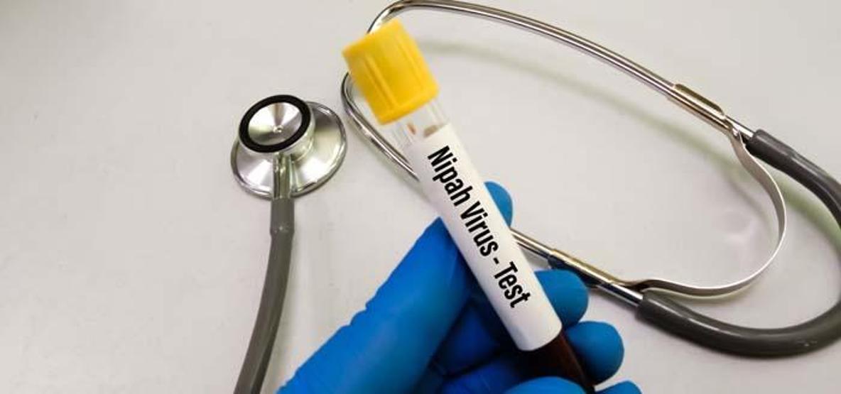 Virüs Yayılıyor: Hindistandan Dünyaya Sıçrayan Gizemli Salgın Ölüm Oranı Korkunç Seviyede Havalimanlarında Önlemler Sıkılaştırıldı