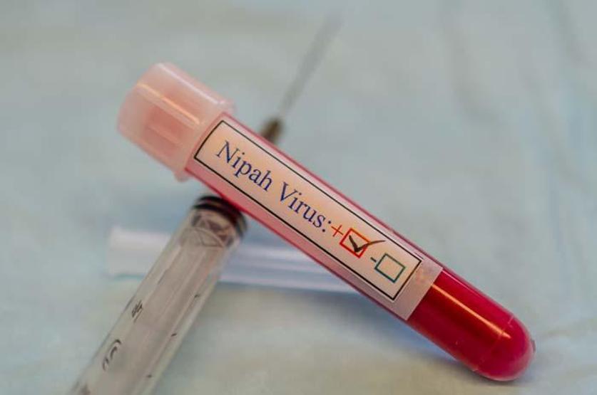 Nipah Virüsüne Karşı Küresel Endişe: Sağlık Taramaları Başlatıldı Uzmanları Uyarıyor Nipah Virüsü Nedir, Nasıl Bulaşır, Belirtileri Neler