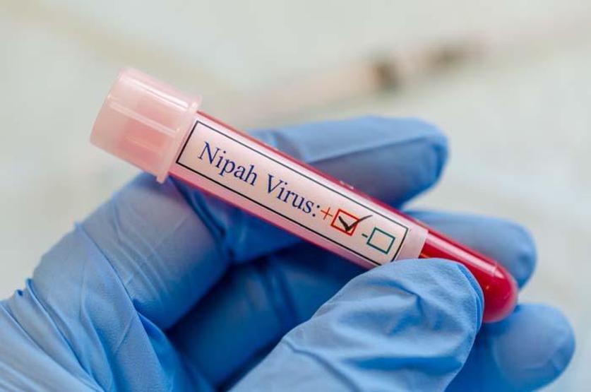 Nipah Virüsüne Karşı Küresel Endişe: Sağlık Taramaları Başlatıldı Uzmanları Uyarıyor Nipah Virüsü Nedir, Nasıl Bulaşır, Belirtileri Neler