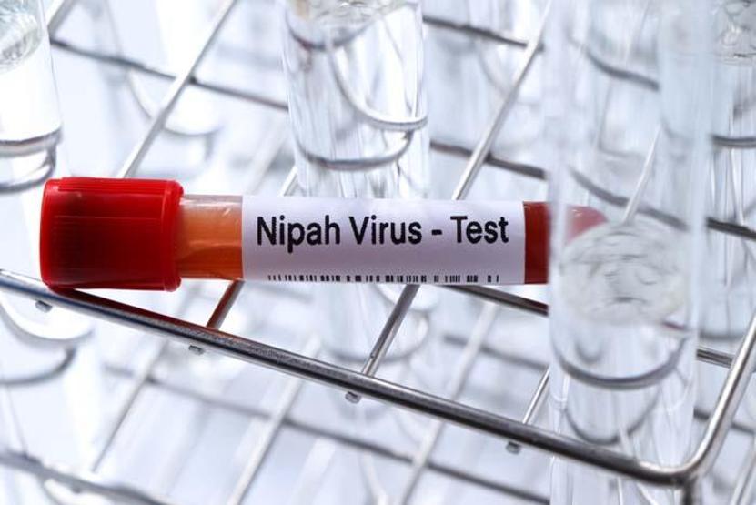 Nipah Virüsüne Karşı Küresel Endişe: Sağlık Taramaları Başlatıldı Uzmanları Uyarıyor Nipah Virüsü Nedir, Nasıl Bulaşır, Belirtileri Neler
