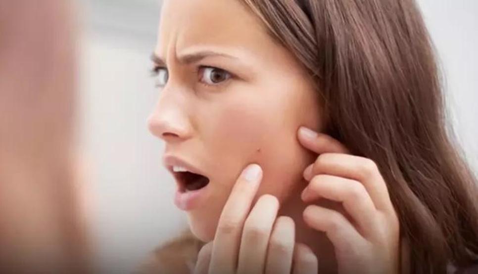 SIK YAPILAN 10 CİLT BAKIMI HATASI Güzelleşeyim derken bu cilt problemleriyle uğraşmayın: Akne, sivilce, siyah nokta, kızarıklık ve pullanma