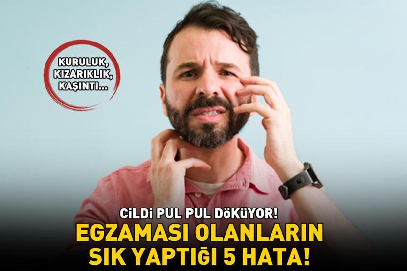 EGZAMASI OLANLARIN SIK YAPTIĞI 5 HATA Cildi pul pul döküyor; kuruluk, kızarıklık ve kaşıntıya neden oluyor