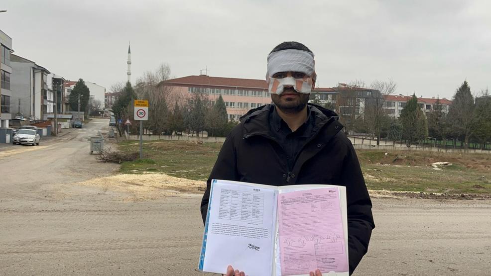 Eskişehirde okulda skandal olay Öğretmen, meslektaşının yüzüne sıcak çay fırlattı