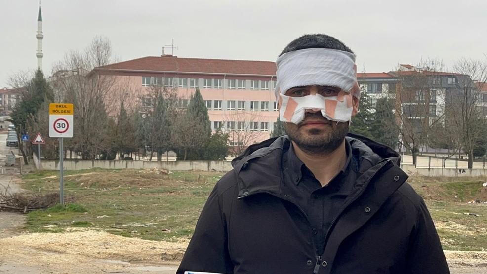 Eskişehirde okulda skandal olay Öğretmen, meslektaşının yüzüne sıcak çay fırlattı