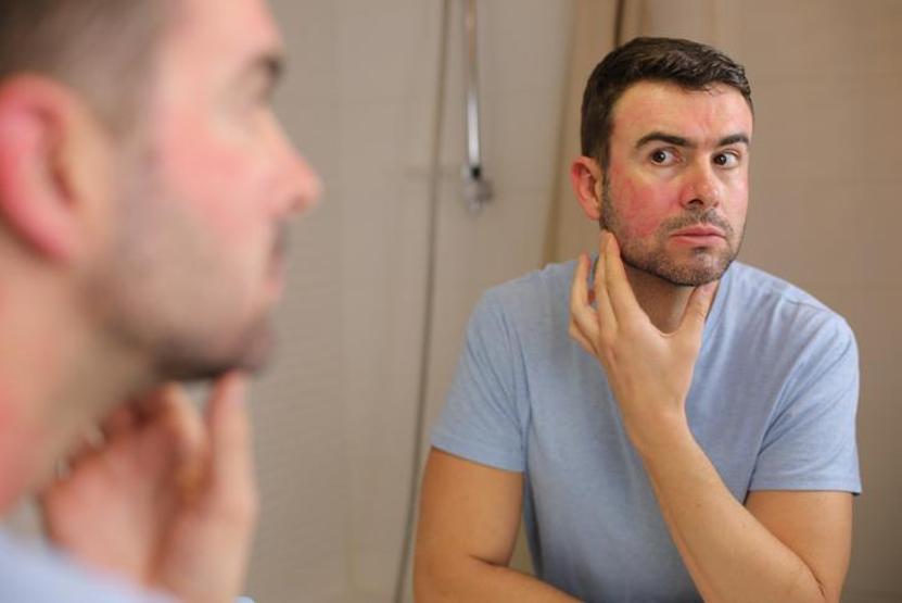 Egzamayı tetikliyor Cildi pul pul döküyor, kaşıntıya neden oluyor Bu besinlerden uzak durun