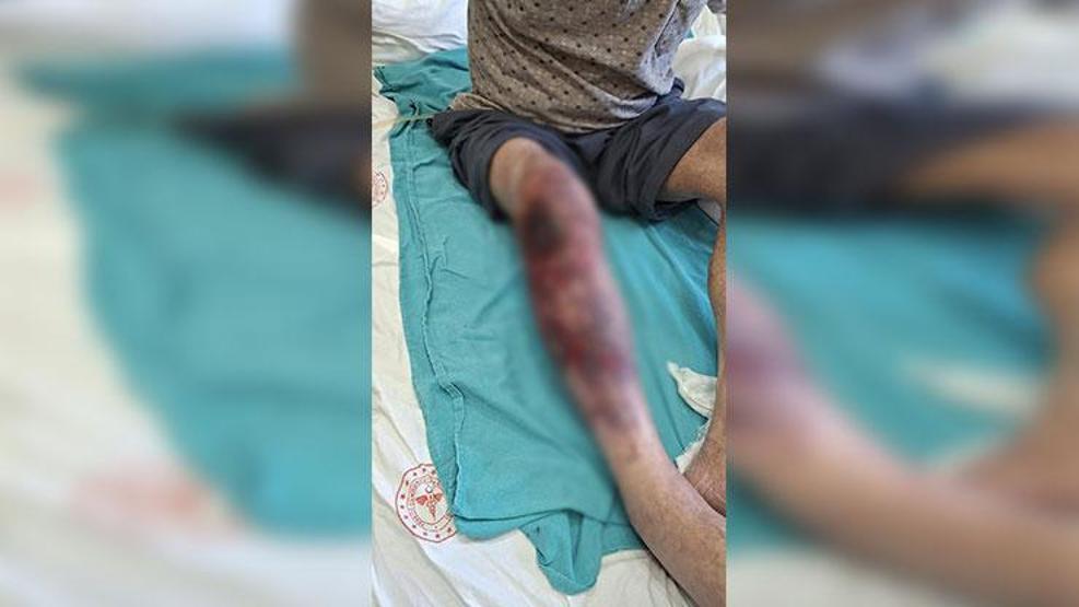 Halis dede hastanelik oldu Bu hatayı yapmayın: Herkesin başına gelebilir