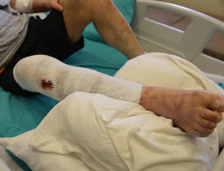 Halis dede hastanelik oldu Bu hatayı yapmayın: Herkesin başına gelebilir