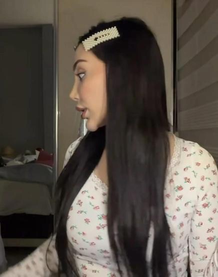 Kısmetse Olur’da yarışmıştı Perinaz Shiri’nin son hali şoke etti