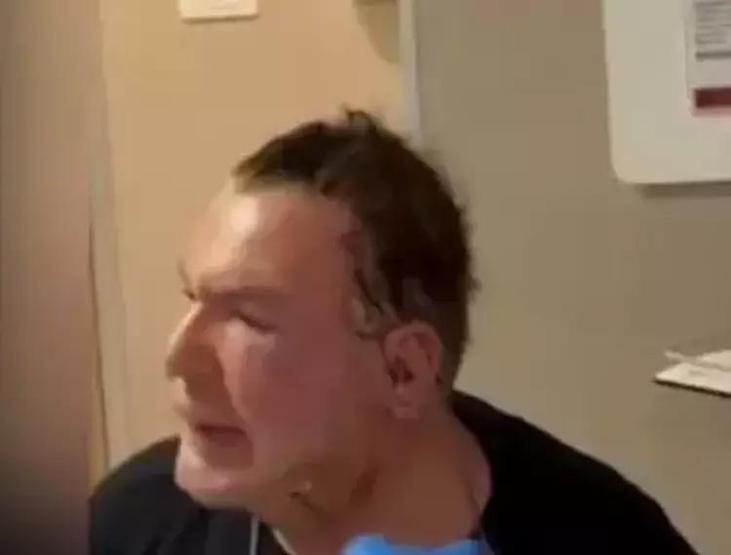 Yaptırdığı Dolgular Nedeniyle Yüzü Deforme Olmuştu Kuşum Aydın, Bıçak Altına Yattı İşte Ameliyat Sonrası Son Hali... Takipçileri Şaşkına Döndü