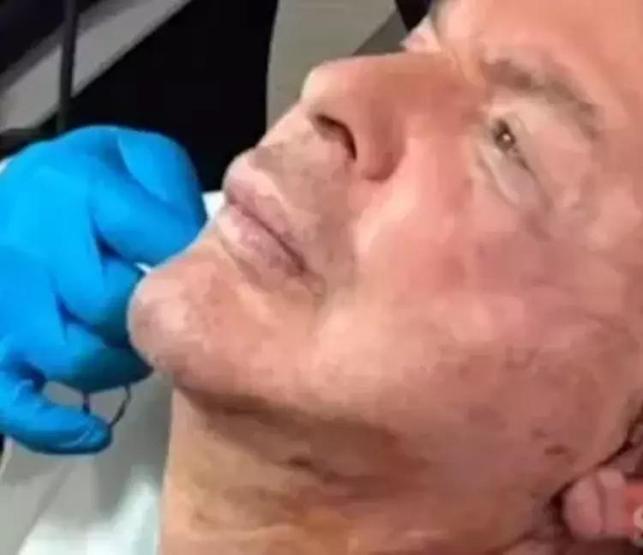 Yaptırdığı Dolgular Nedeniyle Yüzü Deforme Olmuştu Kuşum Aydın, Bıçak Altına Yattı İşte Ameliyat Sonrası Son Hali... Takipçileri Şaşkına Döndü