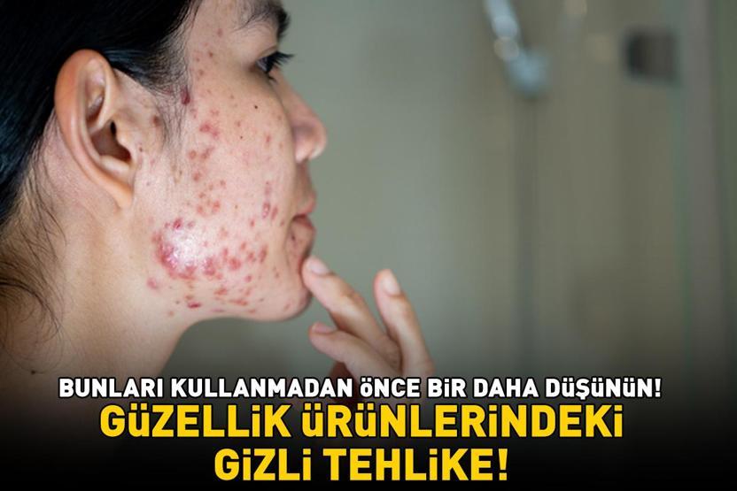 Güzellik ürünlerindeki gizli tehlike Bunları kullanmadan önce bir daha düşünün Nelere sebep olmuyor ki: Sivilce, akne, siyah nokta...