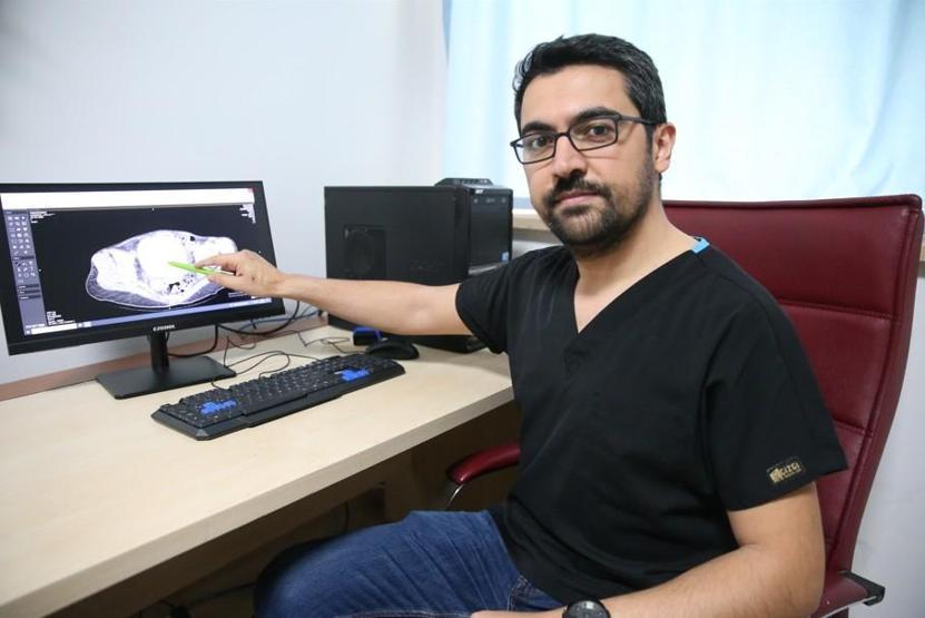 İdrar kanalı ve mesaneden yarım kiloya yakın 6 taş çıkarıldı Doktorlar bile şaşkına döndü