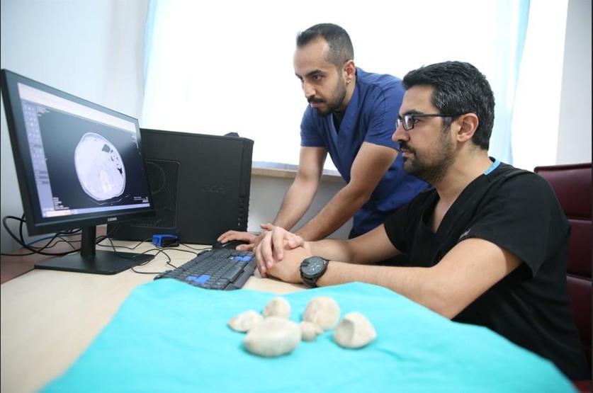 İdrar kanalı ve mesaneden yarım kiloya yakın 6 taş çıkarıldı Doktorlar bile şaşkına döndü