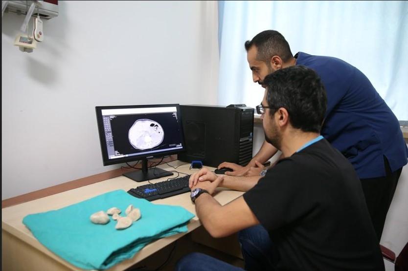 İdrar kanalı ve mesaneden yarım kiloya yakın 6 taş çıkarıldı Doktorlar bile şaşkına döndü