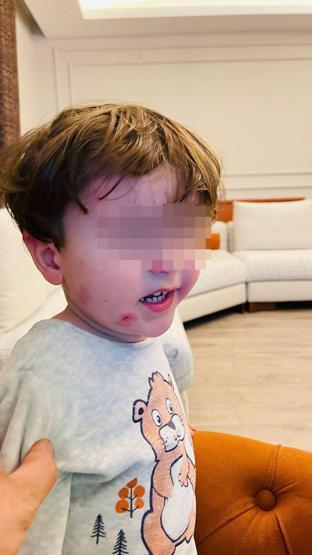 Özel kreşte skandal 2,5 yaşındaki çocuğa darp