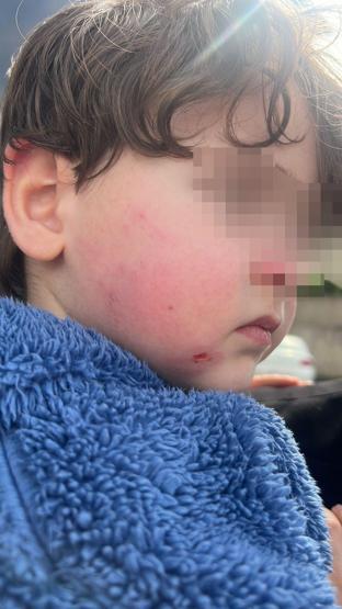 Özel kreşte skandal 2,5 yaşındaki çocuğa darp