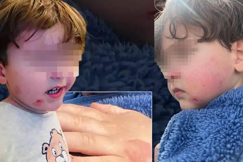 Özel kreşte skandal 2,5 yaşındaki çocuğa darp