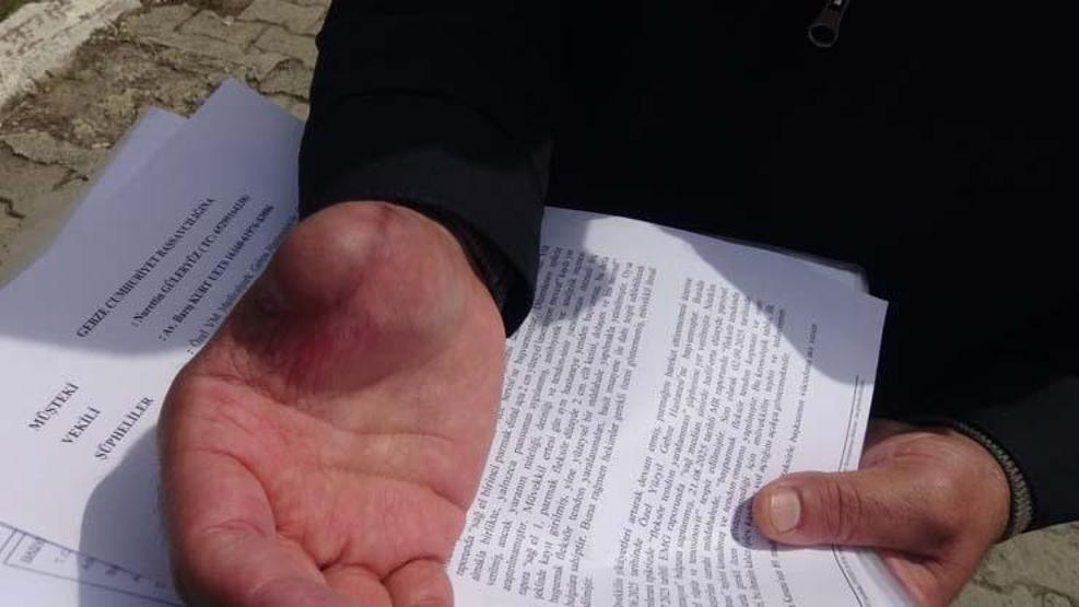 Bıçak kesiği hayatını kararttı: Parmağım çürümeye başladı