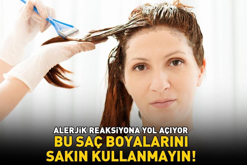 Bu saç boyalarını sakın kullanmayın Alerjik reaksiyona yol açıyor, saç derisini zayıflatıyor