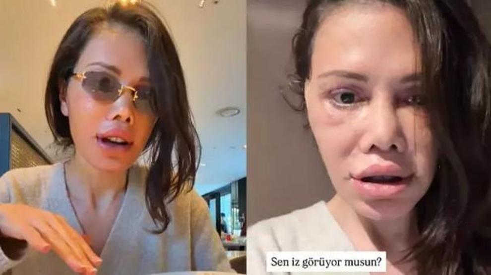Didem Ceran’dan dikkat çeken paylaşım “Bu bir estetik değil, yeniden doğuş”