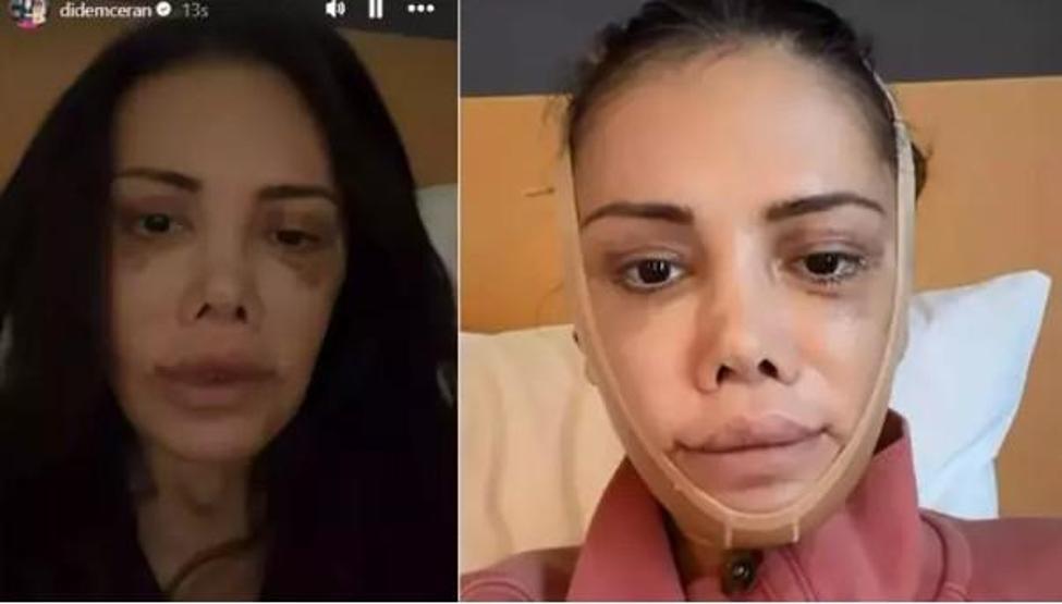 Didem Ceran’dan dikkat çeken paylaşım “Bu bir estetik değil, yeniden doğuş”