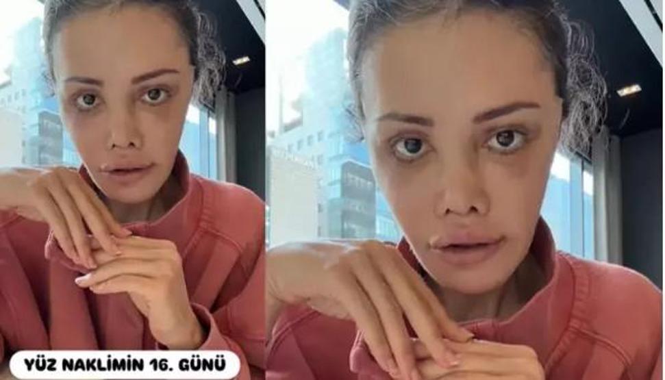 Didem Ceran’dan dikkat çeken paylaşım “Bu bir estetik değil, yeniden doğuş”