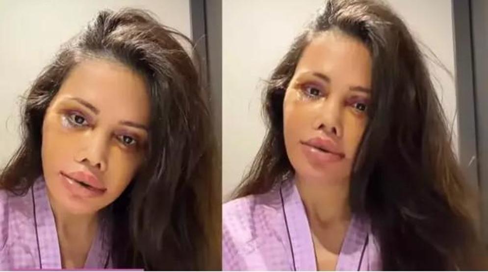 Didem Ceran’dan dikkat çeken paylaşım “Bu bir estetik değil, yeniden doğuş”