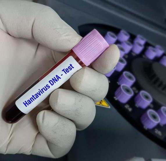 7 Vaka, 3 Ölüm: Kemirgen Kaynaklı Hantavirüs, Krize Yol Açtı: DSÖ Küresel Riskin Düşük Olduğunu Açıkladı
