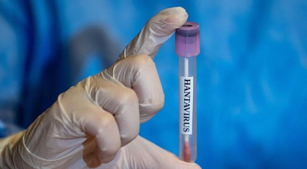 HANTAVİRÜS KABUSU Ölüm oranı yüzde 60a kadar çıkabiliyor Hastalıkla savaşanlar noktayı koydu: Dünyadaki cehennem