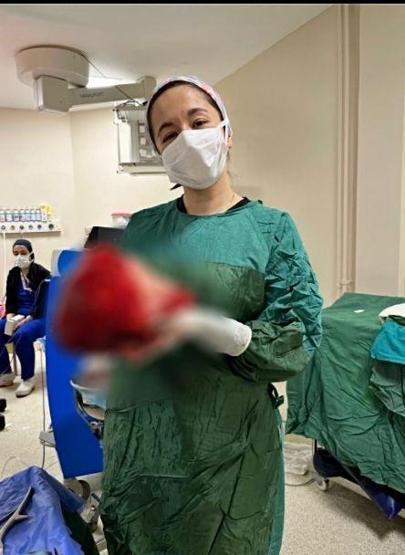 Sivasta sıra dışı ameliyat 7 kilo 750 gram kitle çıkarıldı