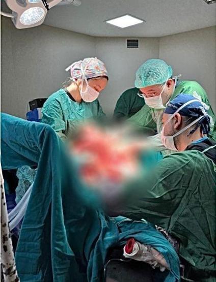 Sivasta sıra dışı ameliyat 7 kilo 750 gram kitle çıkarıldı