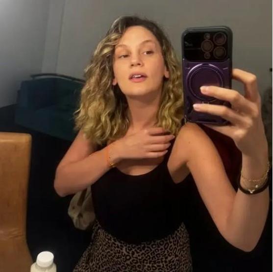 Farah Zeynep Abdullah’tan korkutan paylaşım Vücudundaki morluklar dikkat çekti