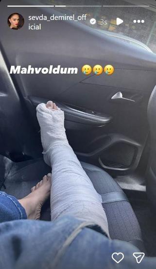 TALİHSİZ KAZA Sevda Demirel ayağını kırdı: Mahvoldum