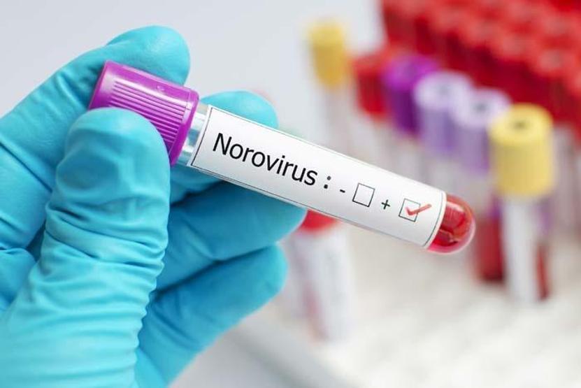 Kısa Sürede Yayılabiliyor: NOROVİRÜS Alarmı Ani Başlayan Bu Belirtilere Dikkat