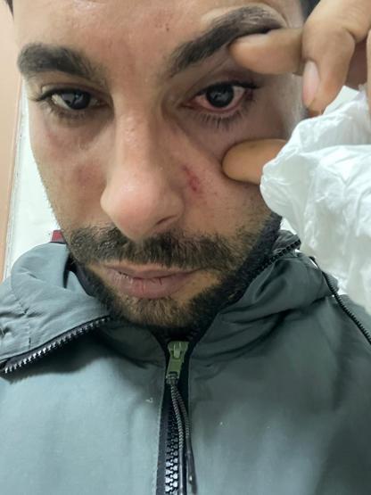 Rapor isteği sonrası hakaret iddiası: Hastaya yumruk atan doktora hapis istemi