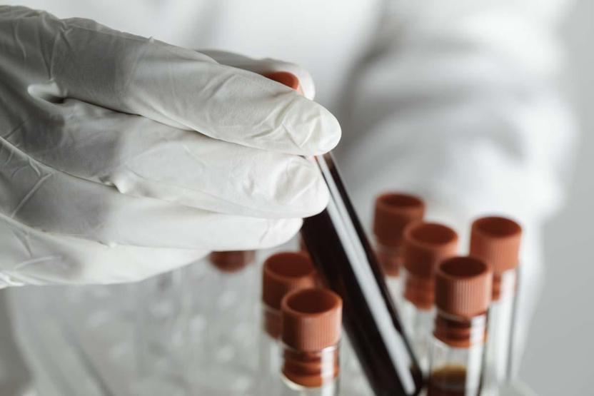 Beyindeki Sessiz Tehlike Kanda Ortaya Çıkabilir Bilim İnsanlarını Heyecanlandıran Gelişme: Alzheimer İçin Erken Uyarı Testi...