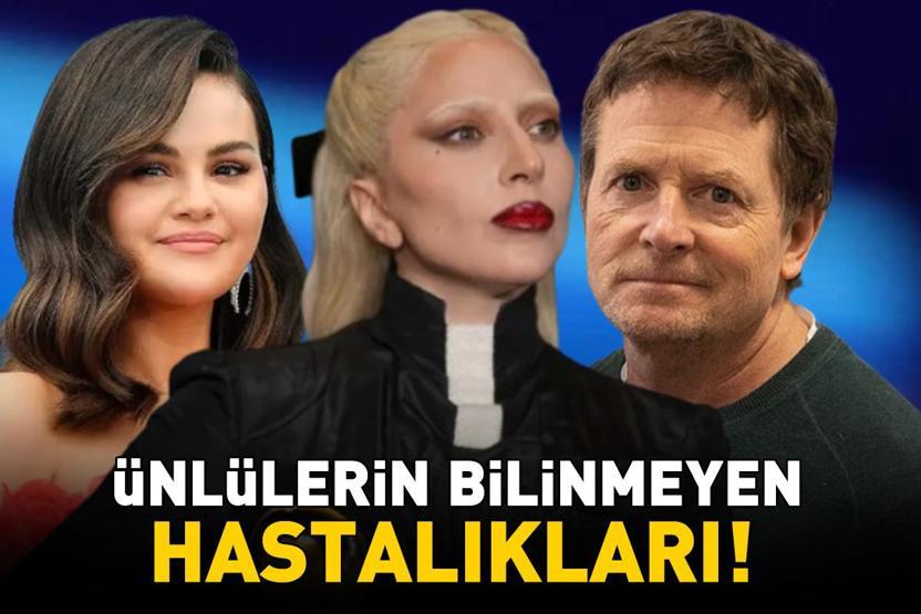Duyan Şaşırıyor Ünlülerin Bilinmeyen Hastalıkları