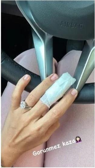 Buse Varol’un “Görünmez kaza” paylaşımı gündem oldu: Parmağı sargılı görüntülendi