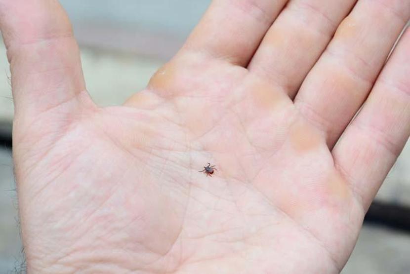 KENE VÜCUTTAN NASIL ÇIKARILIR Aman Dikkat Böyle Dokunan Yandı Yanlış Müdahale Hayati Olabilir... Uzmanlardan Net Uyarı
