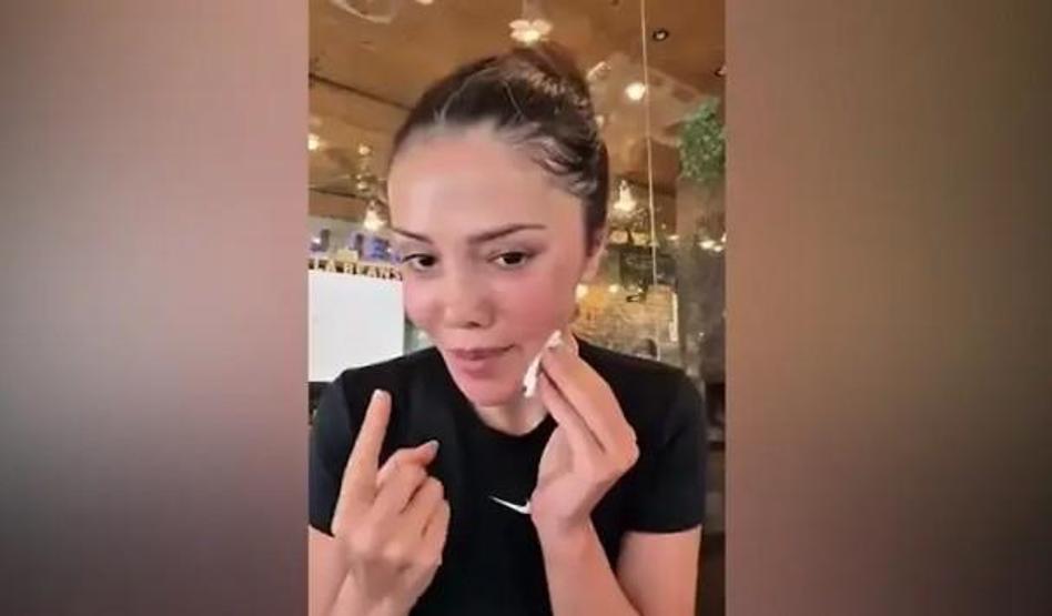 Yüz nakli sonrası değişimiyle gündemdeydi Didem Ceran kendisini dünyaca ünlü yıldızla kıyasladı